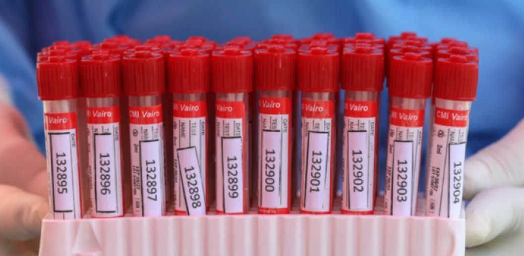 242 са новите случаи на коронавирус у нас при направени 2723